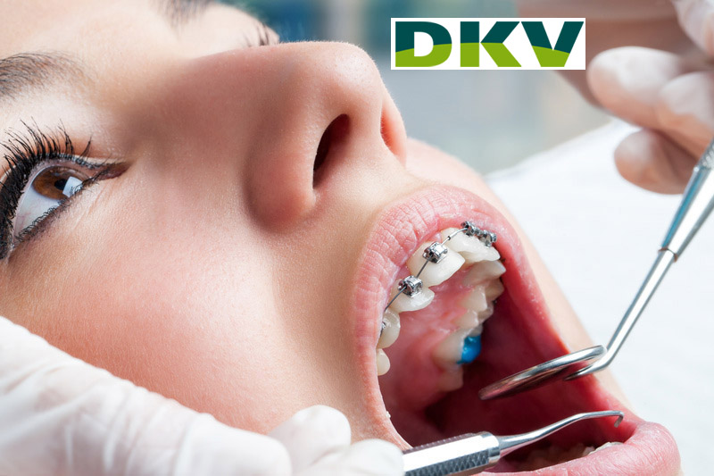 DKV KombiMed Zahnspangenversicherung